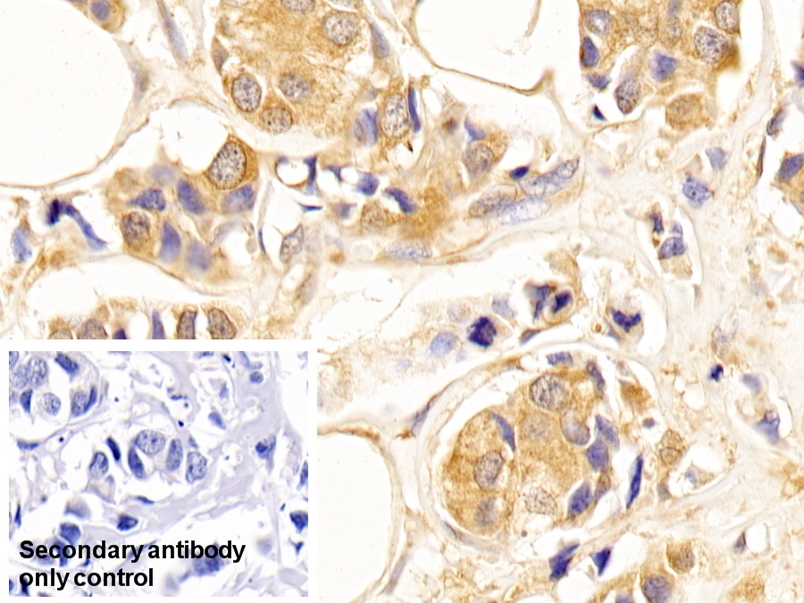 Anti-Tubulin Beta (TUBb) Monoclonal Antibody