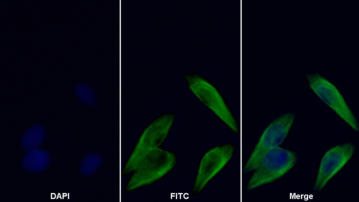 Anti-Tubulin Beta (TUBb) Monoclonal Antibody