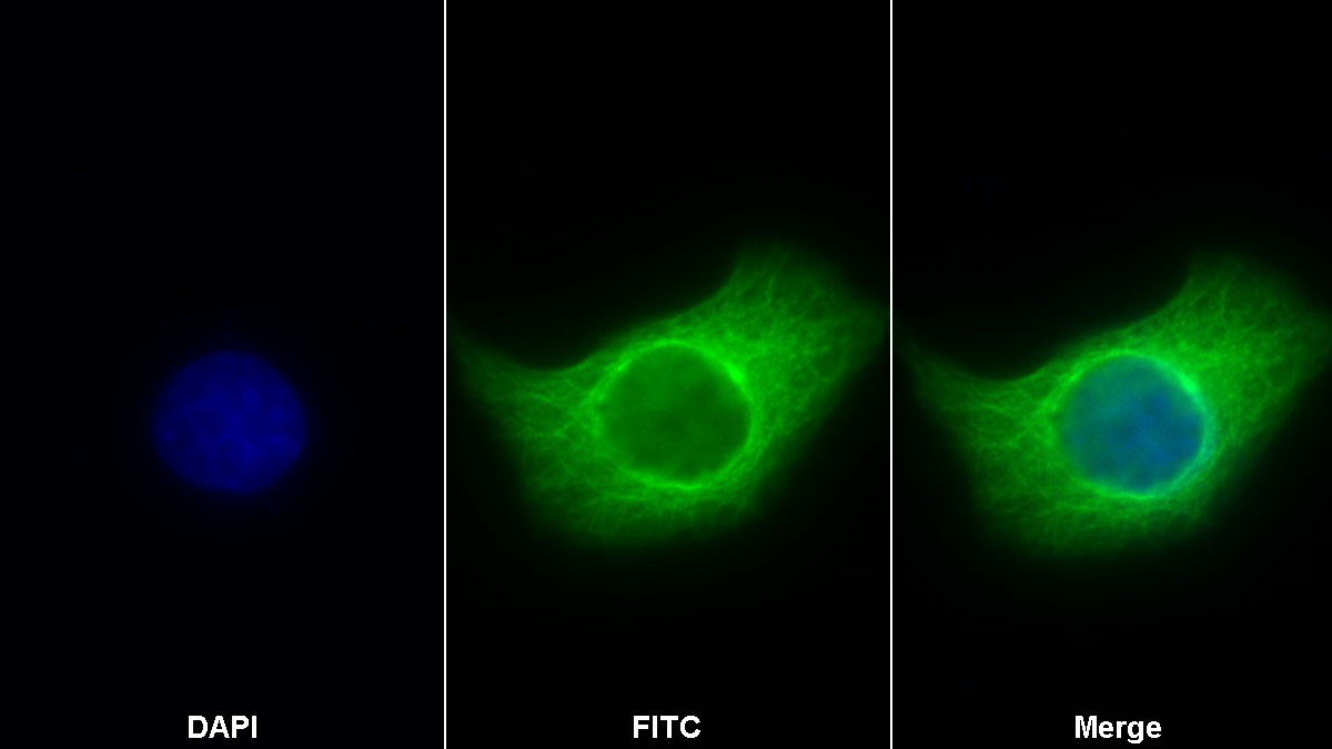 Anti-Tubulin Beta (TUBb) Monoclonal Antibody