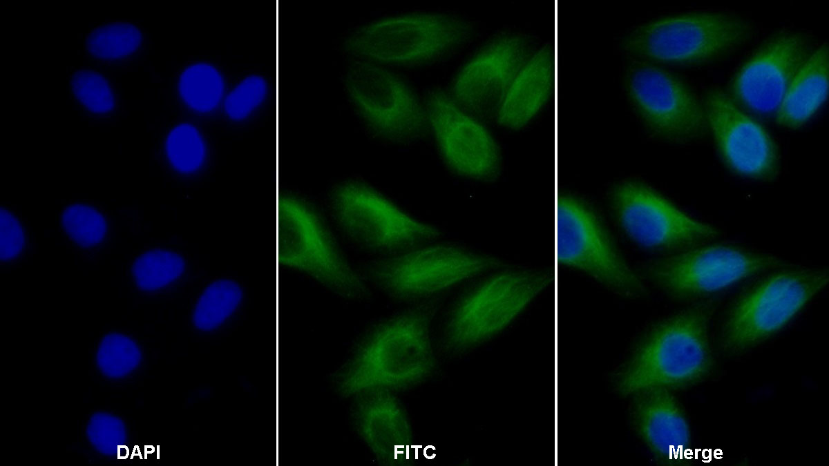 Anti-Tubulin Beta (TUBb) Monoclonal Antibody