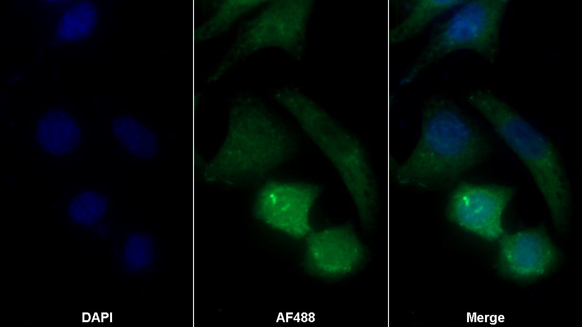 Anti-Glyceraldehyde-3-Phosphate Dehydrogenase (GAPDH) Monoclonal Antibody