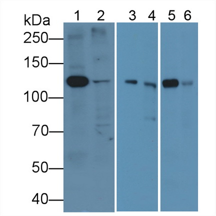 Anti-Platelet Derived Growth Factor Receptor Alpha (PDGFRa) Polyclonal Antibody