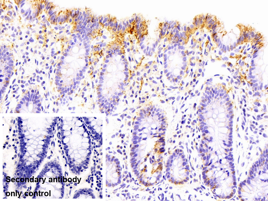Anti-ATPase, Na+/K+ Transporting Alpha 1 Polypeptide (ATP1a1) Polyclonal Antibody
