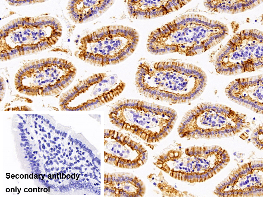 Anti-ATPase, Na+/K+ Transporting Alpha 1 Polypeptide (ATP1a1) Polyclonal Antibody