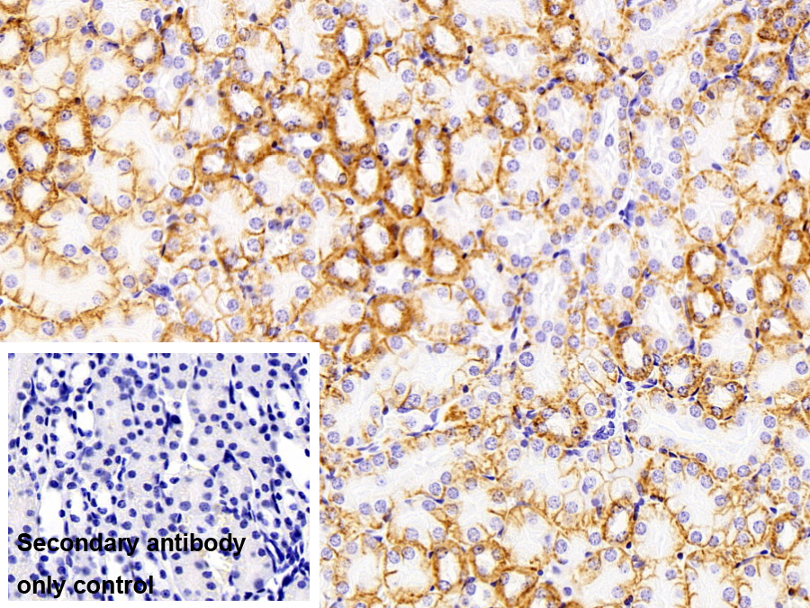 Anti-ATPase, Na+/K+ Transporting Alpha 1 Polypeptide (ATP1a1) Polyclonal Antibody