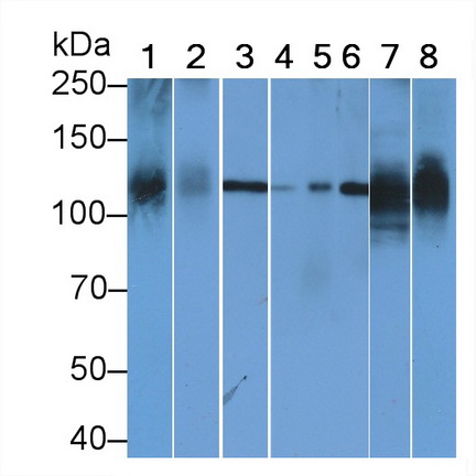 Anti-ATPase, Na+/K+ Transporting Alpha 1 Polypeptide (ATP1a1) Monoclonal Antibody