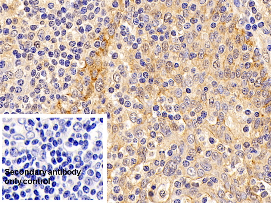 Anti-ATPase, Na+/K+ Transporting Alpha 1 Polypeptide (ATP1a1) Monoclonal Antibody