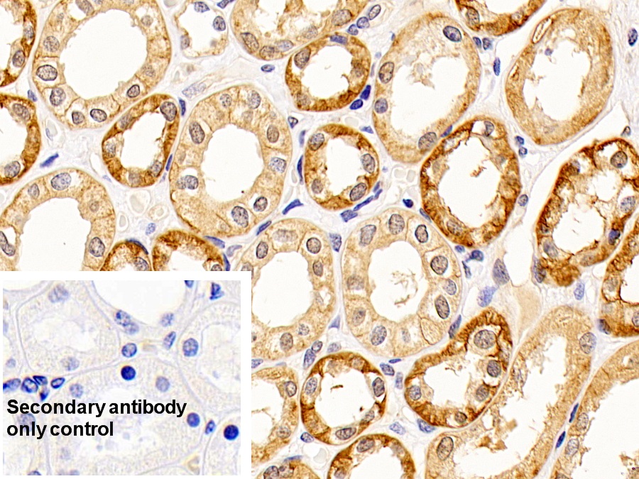 Anti-ATPase, Na+/K+ Transporting Alpha 1 Polypeptide (ATP1a1) Monoclonal Antibody