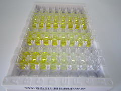 ELISA Kit for Adrenomedullin (ADM)