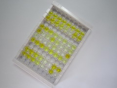 ELISA Kit for Calcitonin (CT)