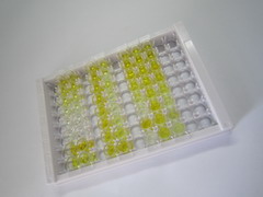 ELISA Kit for Calcitonin (CT)