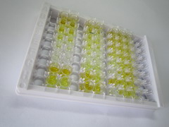 ELISA Kit for Trypsinogen Activation Peptide (TAP)