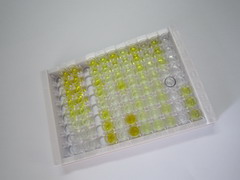 ELISA Kit for Adrenocorticotropic Hormone (ACTH)