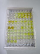 ELISA Kit for Inhibin Beta A (INHbA)