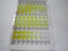 ELISA Kit for Parathyroid Hormone (PTH)