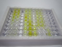 ELISA Kit for Alpha-Crosslaps (aCTx)