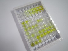 ELISA Kit for Noradrenaline (NE)