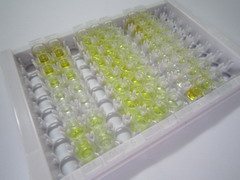 ELISA Kit for Procollagen I N-Terminal Propeptide (PINP)