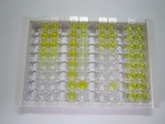 ELISA Kit for Gastrin (GT)