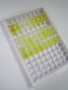 ELISA Kit for Hemoglobin (HB)