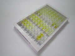 ELISA Kit for Reverse Triiodothyronine (rT3)