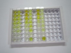 ELISA Kit for Gastrin Releasing Peptide (GRP)