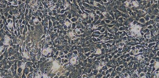 Primary Human Cardiac Microvascular Endothelial Cells (CMEC)