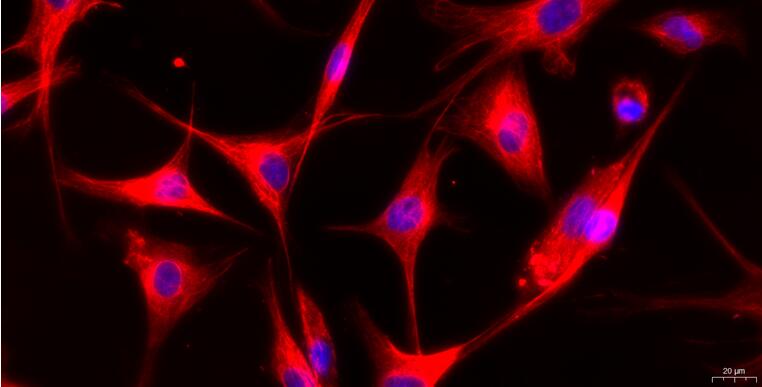 Primary Caprine Aortic Endothelial Cells (AEC)