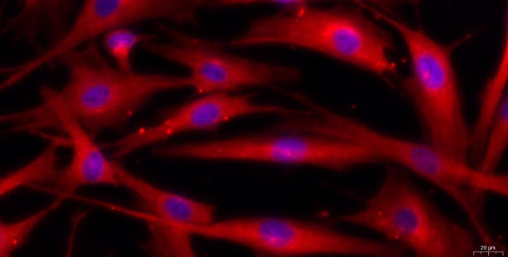 Primary Caprine Aortic Endothelial Cells (AEC)