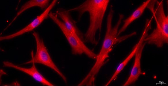 Primary Cavia Aortic Endothelial Cells (AEC)
