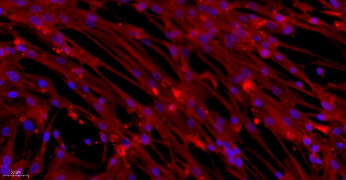 Primary Mouse Aortic Endothelial Cells (AEC)