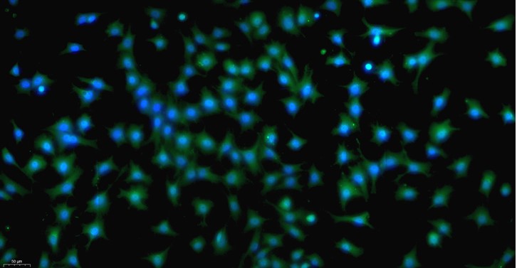 Primary Rat Annulus Fibrosus Cells (AFC)