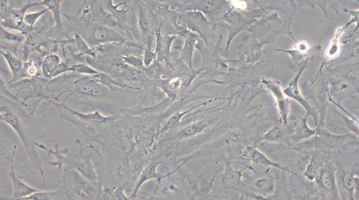Primary Mouse Retinal Astrocytes (RA)