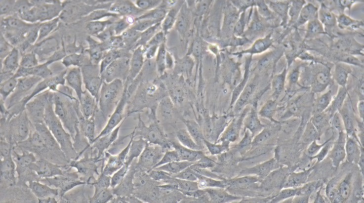 Primary Rabbit Retinal Astrocytes (RA)