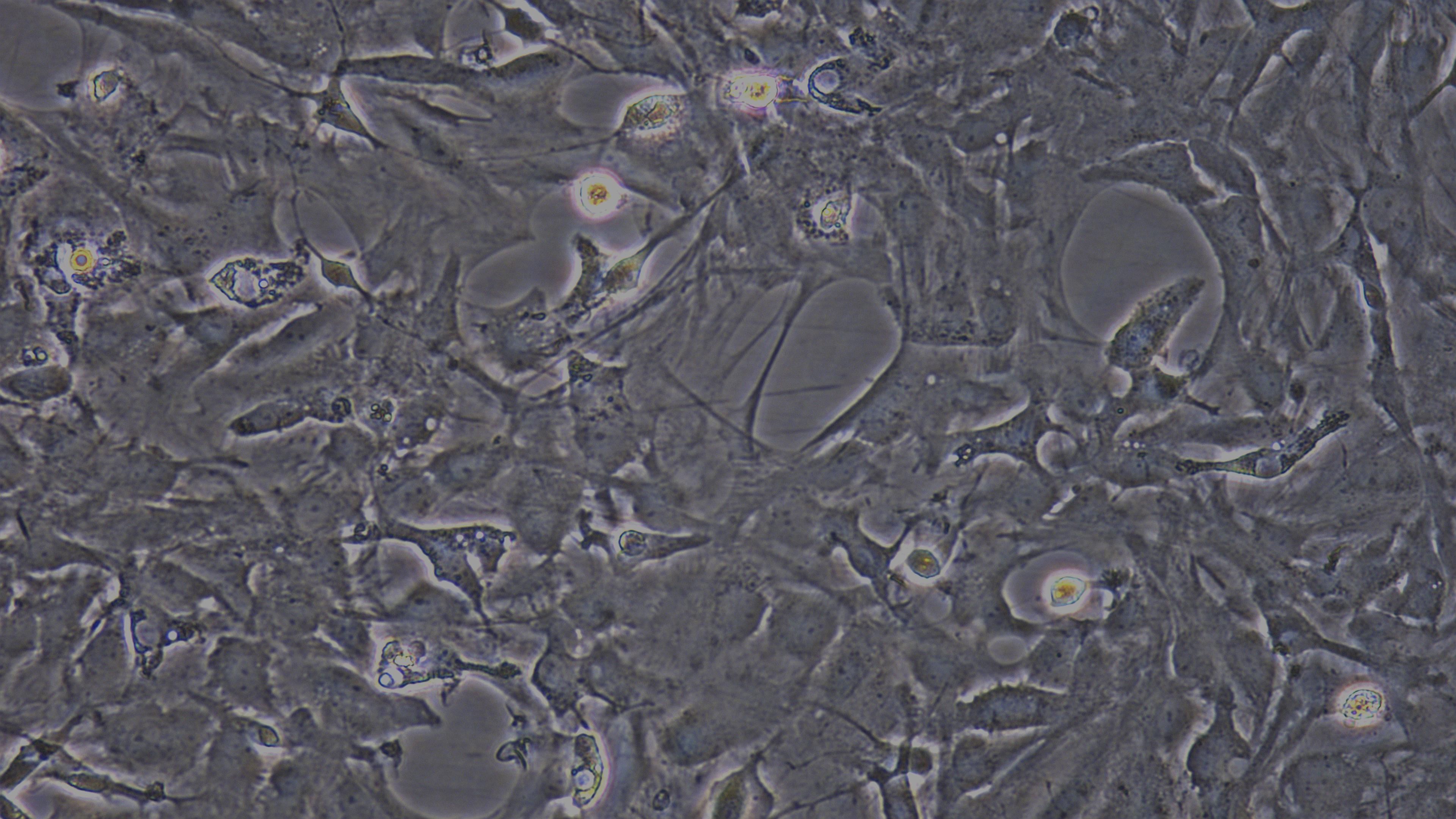 Primary Rat Brain Astrocytes (BA)