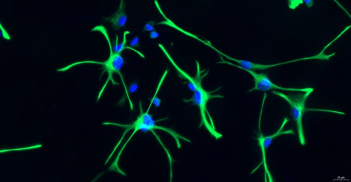 Primary Rat Brain Astrocytes (BA)