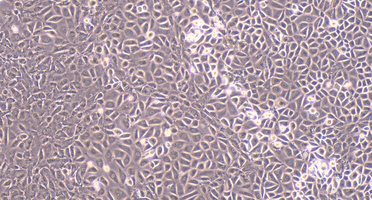 Primary Mouse Pulmonary Microvascular Endothelial Cells (PMEC)