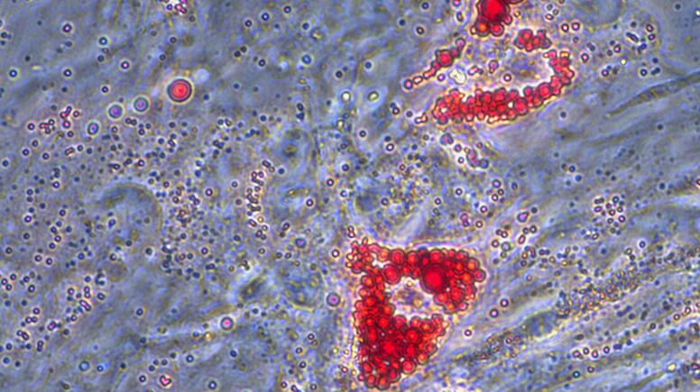 Primary Mouse Subcutaneous Preadipocytes (SPrAD)