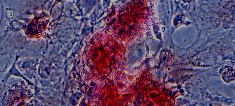 Primary Mouse Subcutaneous Preadipocytes (SPrAD)