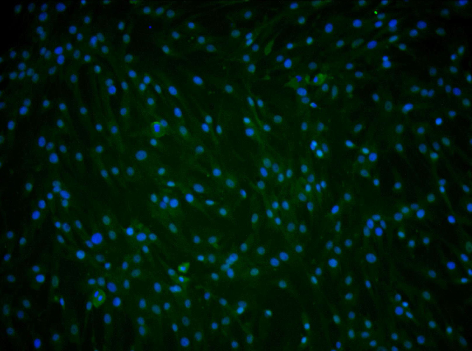 Primary Rat Subcutaneous Preadipocytes (SPrAD)