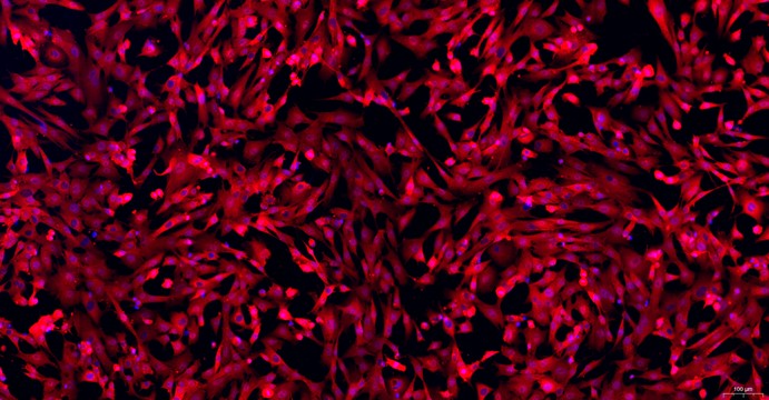 Primary Caprine Pulmonary Fibroblasts (PF)
