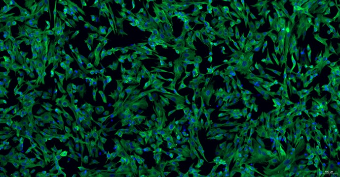 Primary Caprine Pulmonary Fibroblasts (PF)