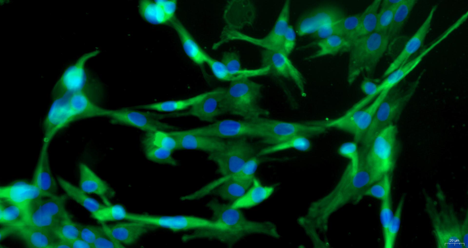 Primary Mouse Pulmonary Fibroblasts (PF)