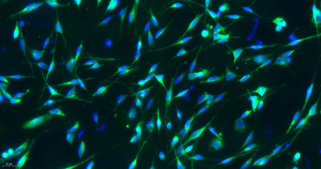Primary Rat Schwann Cells  (SC)