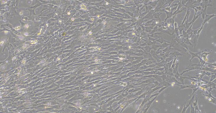 Primary Rat Thyroid Fibroblasts (TF)