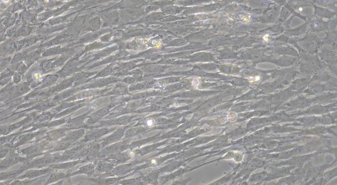 Primary Rat Thyroid Fibroblasts (TF)