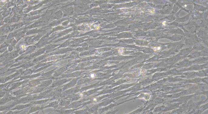 Primary Rat Thyroid Fibroblasts (TF)