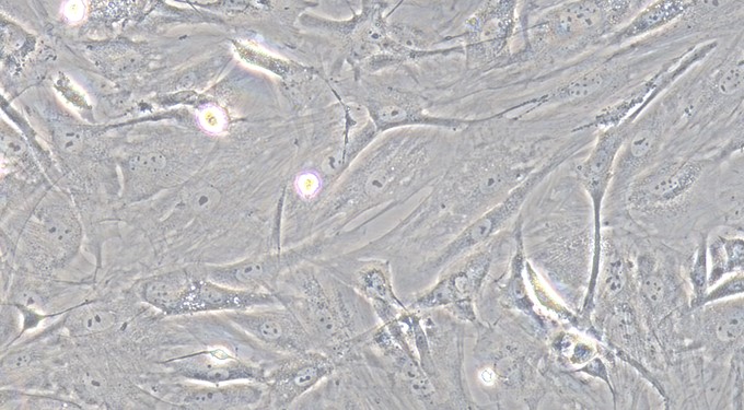 Primary Mouse Meningeal Cells (MC)