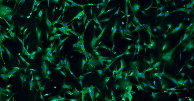 Primary Mouse Meningeal Cells (MC)
