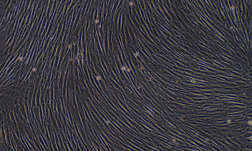 Primary Rabbit Skeletal Muscle Cells (SkMC)